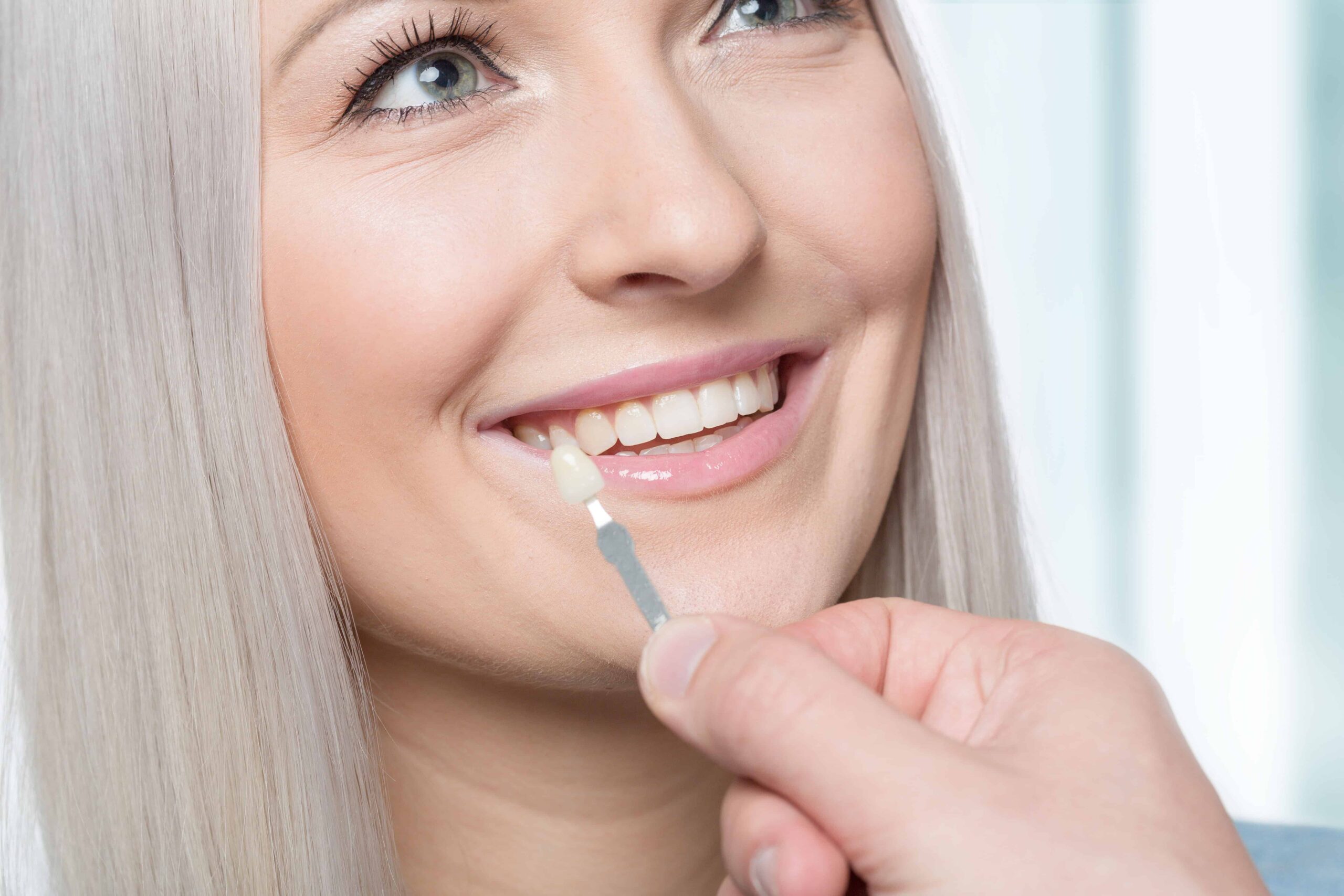 Using shade guide at mouth of smiling woman to check veneer of tooth crown